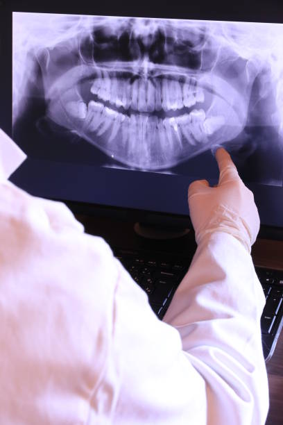 Best Chipped Tooth Repair Near Me  in Pleasant Run, OH